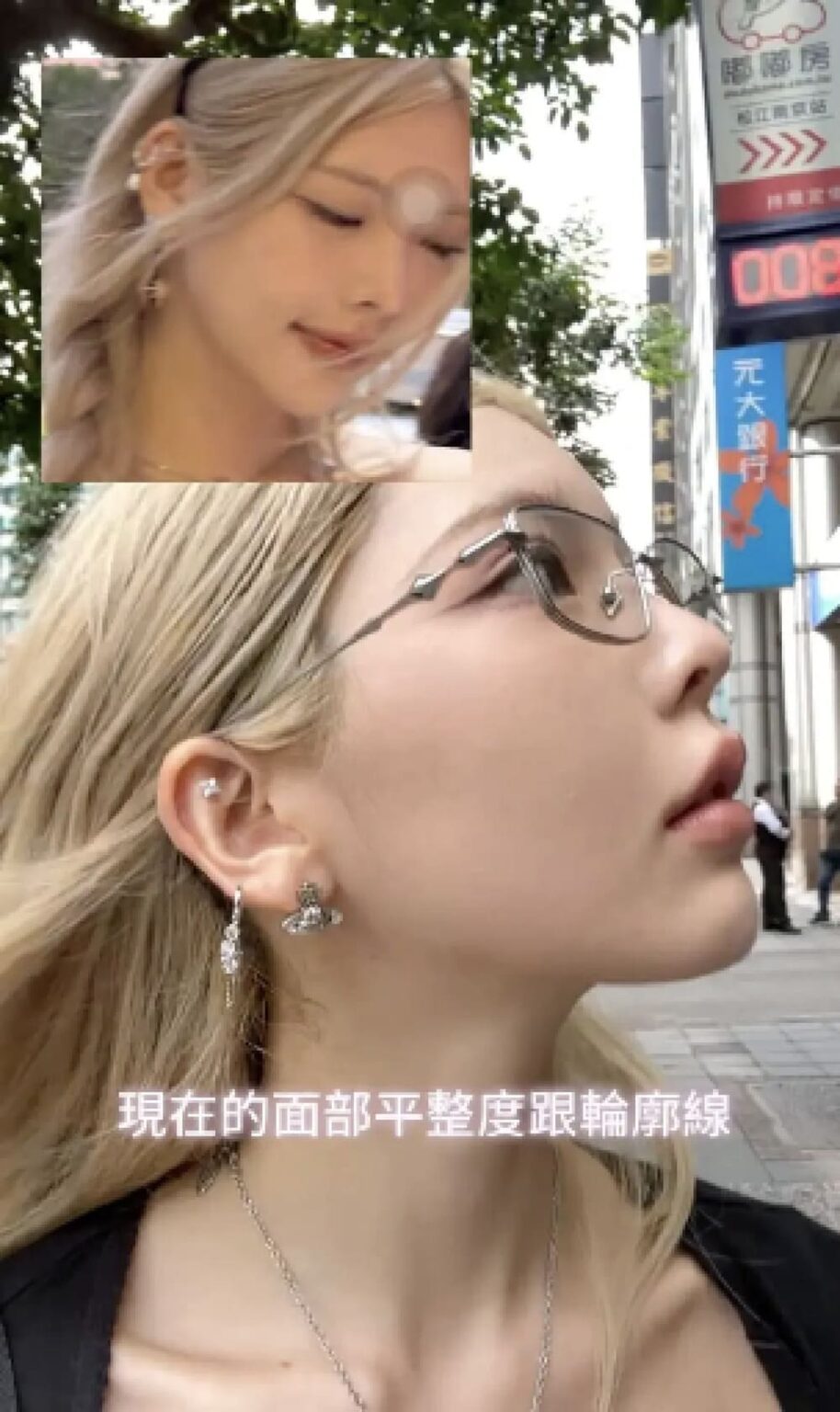 首頁名人推薦 新願美學診所(郭毅昕醫師|台北醫美推薦|台北海芙音波媚必提|海芙電波|海菲秀|探索皮秒|喬雅登|熊貓針推薦)