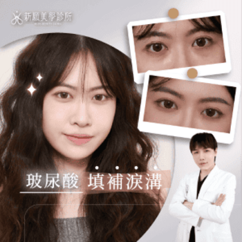 黑眼圈、淚溝怎麼改善？熊貓針治療全解析