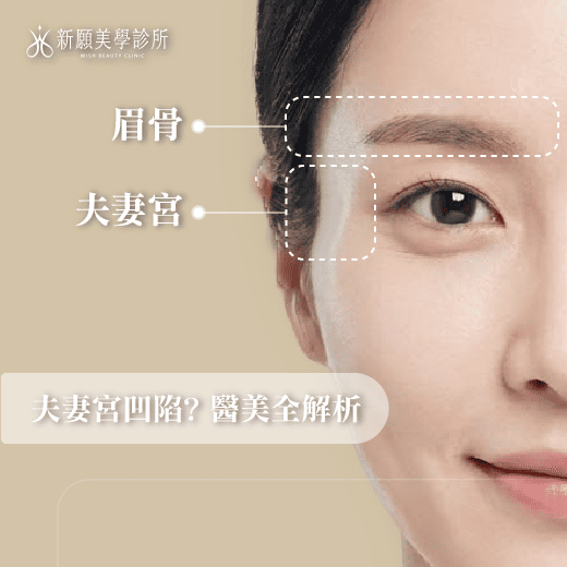 夫妻宮凹陷怎麼辦？從面相、結構到醫美填補全解析