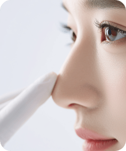 精選項目-鼻雕 新願美學診所（郭毅昕醫師｜台北醫美推薦｜台北海芙音波媚必提｜海芙電波｜海菲秀｜探索皮秒｜喬雅登｜熊貓針推薦）