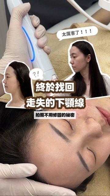 萬萬 新願美學診所(郭毅昕醫師|台北醫美推薦|台北海芙音波媚必提|海芙電波|海菲秀|探索皮秒|喬雅登|熊貓針推薦)