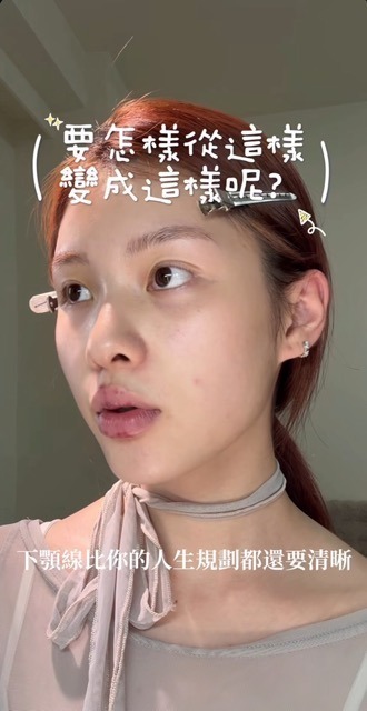 龐奇 新願美學診所(郭毅昕醫師|台北醫美推薦|台北海芙音波媚必提|海芙電波|海菲秀|探索皮秒|喬雅登|熊貓針推薦)