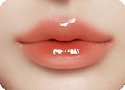 唇形類型-嘟嘟唇-新願美學診所（郭毅昕醫師｜台北醫美推薦｜台北海芙音波媚必提｜海芙電波｜海菲秀｜探索皮秒｜喬雅登｜熊貓針推薦）