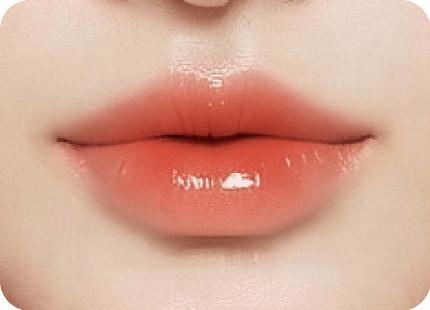 唇形類型-愛心唇-新願美學診所（郭毅昕醫師｜台北醫美推薦｜台北海芙音波媚必提｜海芙電波｜海菲秀｜探索皮秒｜喬雅登｜熊貓針推薦）