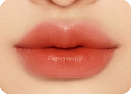 唇形類型-歐美唇 新願美學診所（郭毅昕醫師｜台北醫美推薦｜台北海芙音波媚必提｜海芙電波｜海菲秀｜探索皮秒｜喬雅登｜熊貓針推薦）