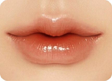 唇形類型-海鷗唇-新願美學診所（郭毅昕醫師｜台北醫美推薦｜台北海芙音波媚必提｜海芙電波｜海菲秀｜探索皮秒｜喬雅登｜熊貓針推薦）