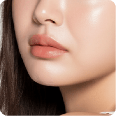 困擾-嘴角下垂-新願美學診所(郭毅昕醫師|台北醫美推薦|台北海芙音波媚必提|海芙電波|海菲秀|探索皮秒|喬雅登|熊貓針推薦)