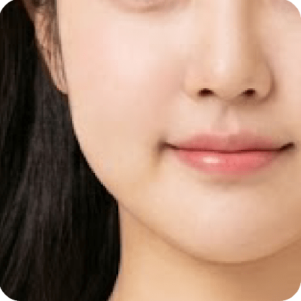 新願美學診所(郭毅昕醫師|台北醫美推薦|台北海芙音波媚必提|海芙電波|海菲秀|探索皮秒|喬雅登|熊貓針推薦)