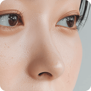 困擾-山根塌陷 新願美學診所（郭毅昕醫師｜台北醫美推薦｜台北海芙音波媚必提｜海芙電波｜海菲秀｜探索皮秒｜喬雅登｜熊貓針推薦）