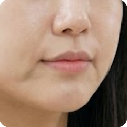 新願美學診所(郭毅昕醫師|台北醫美推薦|台北海芙音波媚必提|海芙電波|海菲秀|探索皮秒|喬雅登|熊貓針推薦)