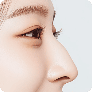 困擾-駝峰鼻 新願美學診所（郭毅昕醫師｜台北醫美推薦｜台北海芙音波媚必提｜海芙電波｜海菲秀｜探索皮秒｜喬雅登｜熊貓針推薦）