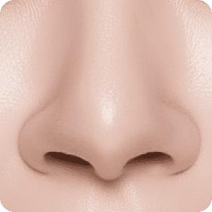 困擾-鼻翼過寬 新願美學診所（郭毅昕醫師｜台北醫美推薦｜台北海芙音波媚必提｜海芙電波｜海菲秀｜探索皮秒｜喬雅登｜熊貓針推薦）