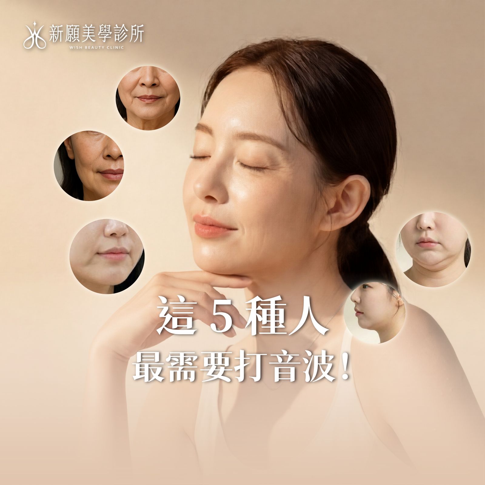 我適合打音波嗎？5種人最需要！快來測測你的臉部鬆弛指數