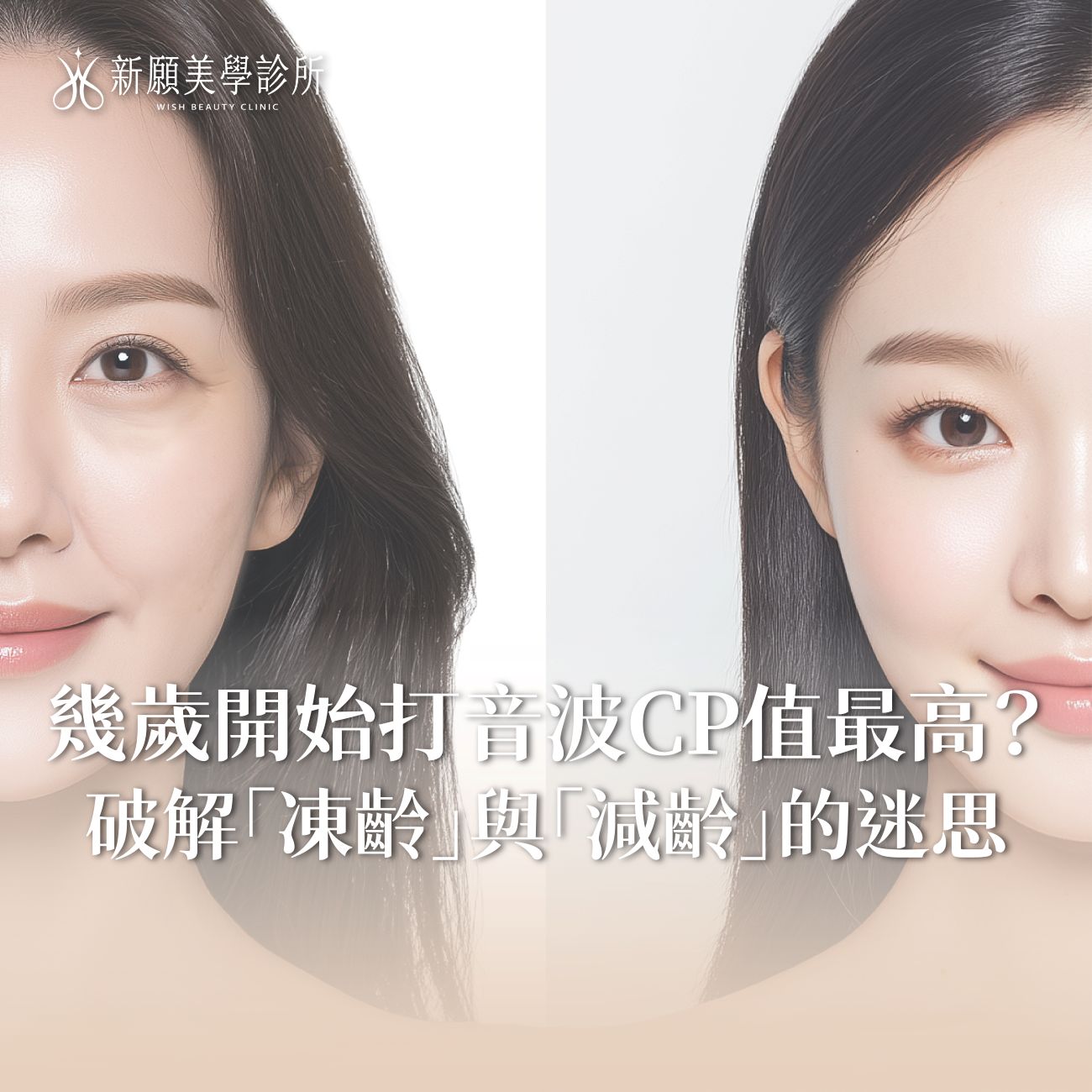 幾歲打音波最好？破解不同年齡層的治療目標迷思