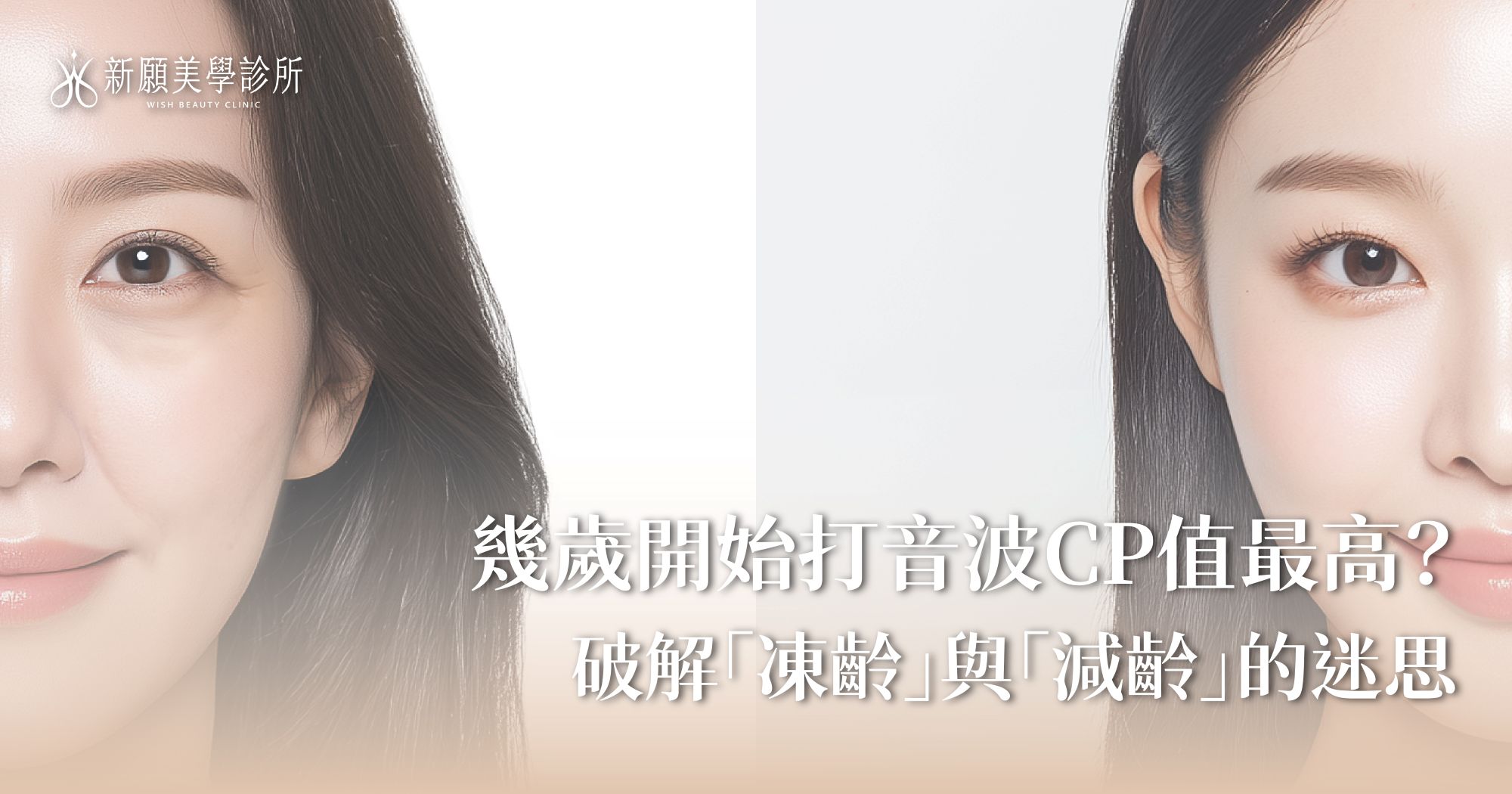 幾歲打音波最好？破解不同年齡層的治療目標迷思