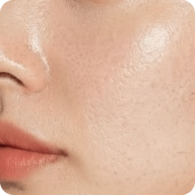 海芙電波 - 新願美學診所（郭毅昕醫師｜台北醫美推薦｜台北海芙音波媚必提｜海芙電波｜海菲秀｜探索皮秒｜喬雅登｜熊貓針推薦）