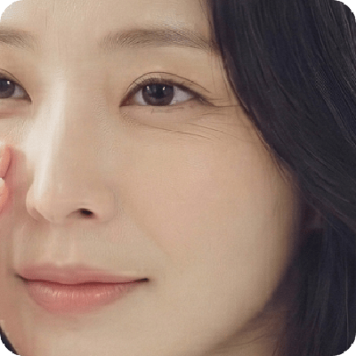 海芙電波 - 新願美學診所（郭毅昕醫師｜台北醫美推薦｜台北海芙音波媚必提｜海芙電波｜海菲秀｜探索皮秒｜喬雅登｜熊貓針推薦）