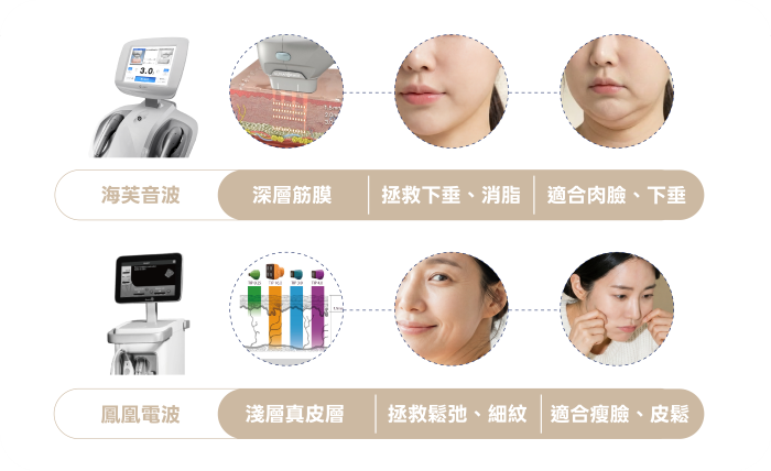 海芙音波第三代效果好嗎？超高CP值！價格、探頭、痛感全解析